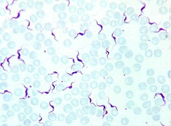 Le coulis avec lail des helminthes