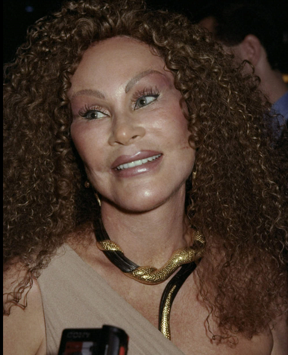 JOCELYN wildenstyein